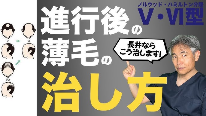 AGA治療・薄毛治療 山口・下関・小倉で治療するなら湘南美容クリニック下関院へ - 下関院