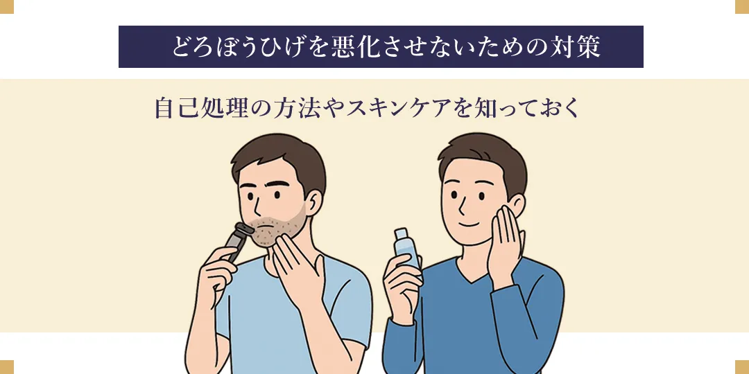 どろぼうひげの製作記