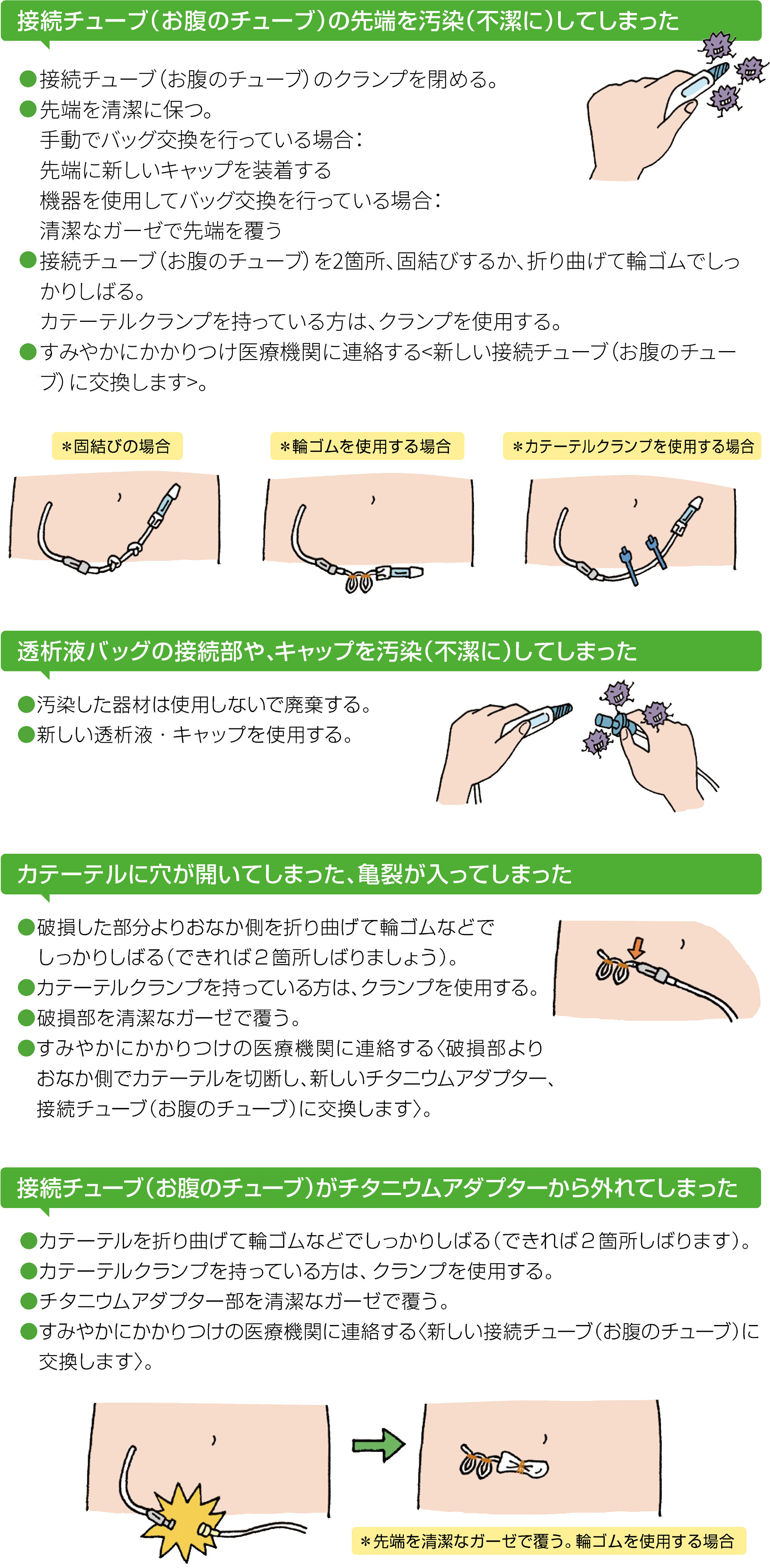 レジでミスした時どう対処したらいいの 教えて。 - 歩きにすと