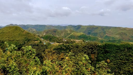 整形外科的知識①：カルカーって何ですか？骨コツ節約！整形外科医