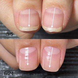 ネイルNGのネイルデザインネイルブック