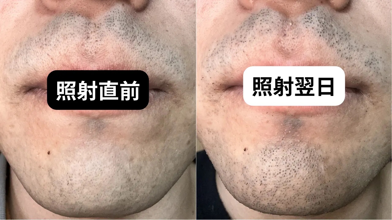 スターウォーズ AT-AT mpc プラモデル 塗装済 どろぼうひげの製作記SSブログ