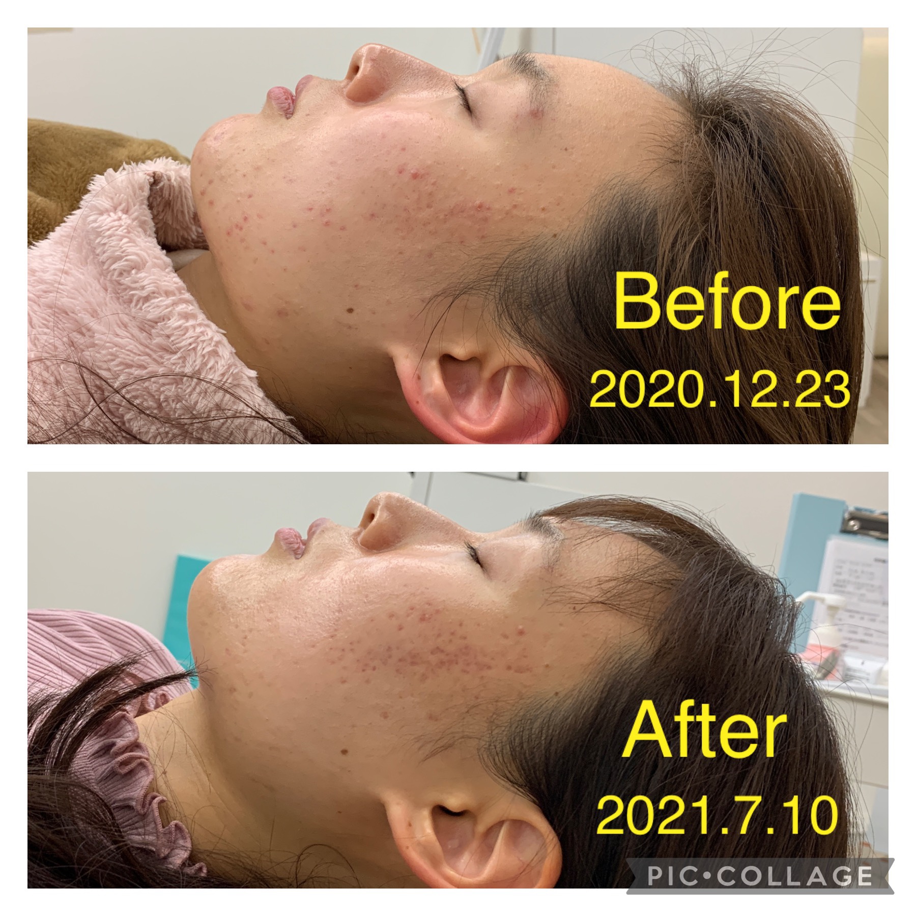 サーバー上の文字化けファイルが削除できない件が解決！ – A2-blog