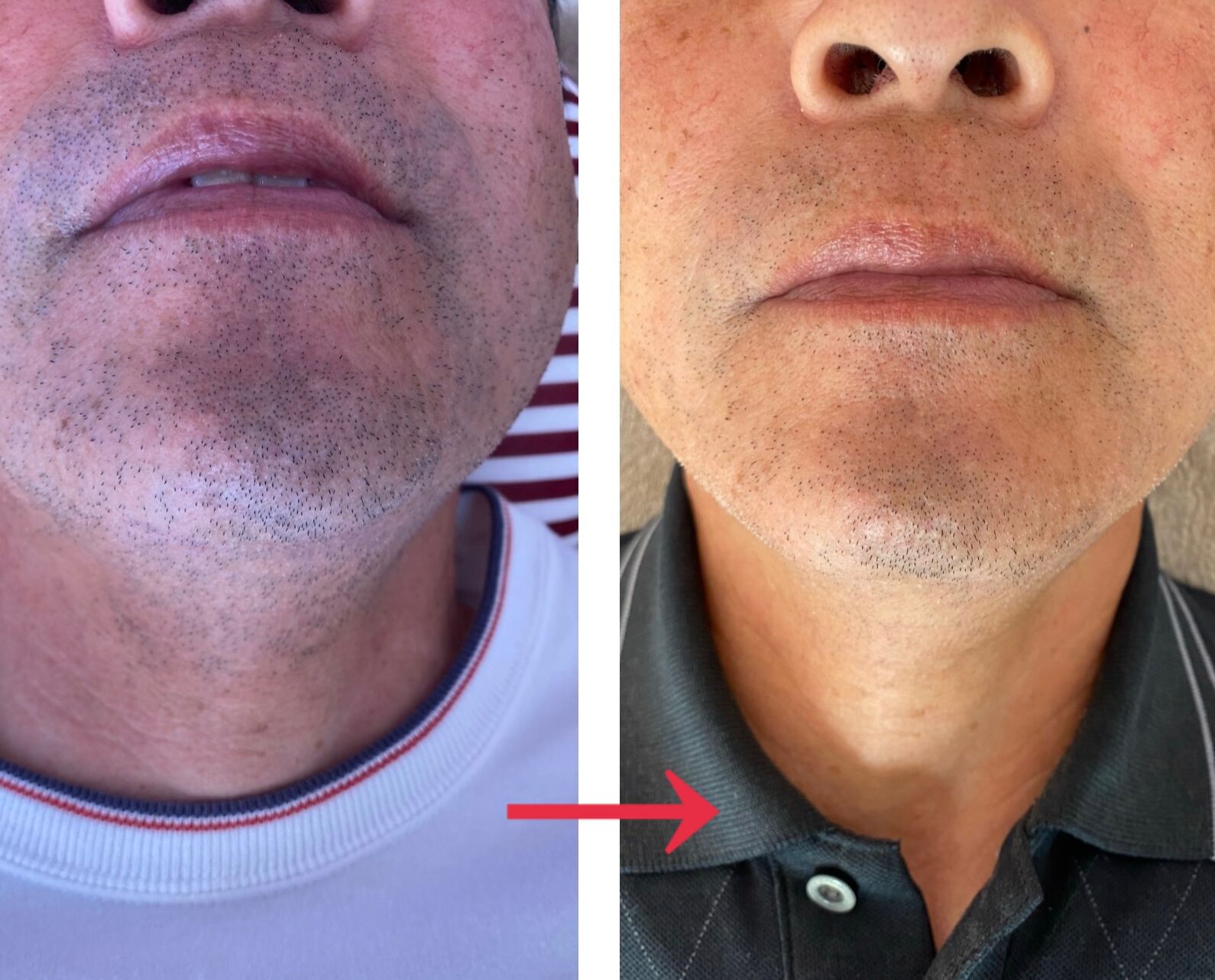 どろぼうひげ on X: 