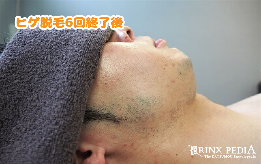 どろぼうひげの製作記