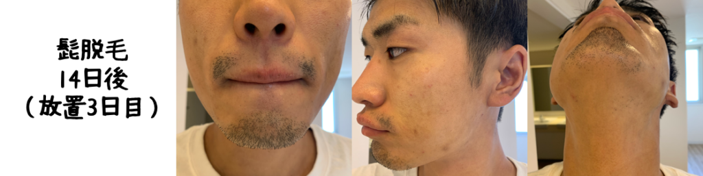 猫の里親募集 兵庫県・雑種・個性的どろぼう髭キジ白超甘えん坊♡いまよ ID:2306-01545 ハグー -みんなのペット里親情報