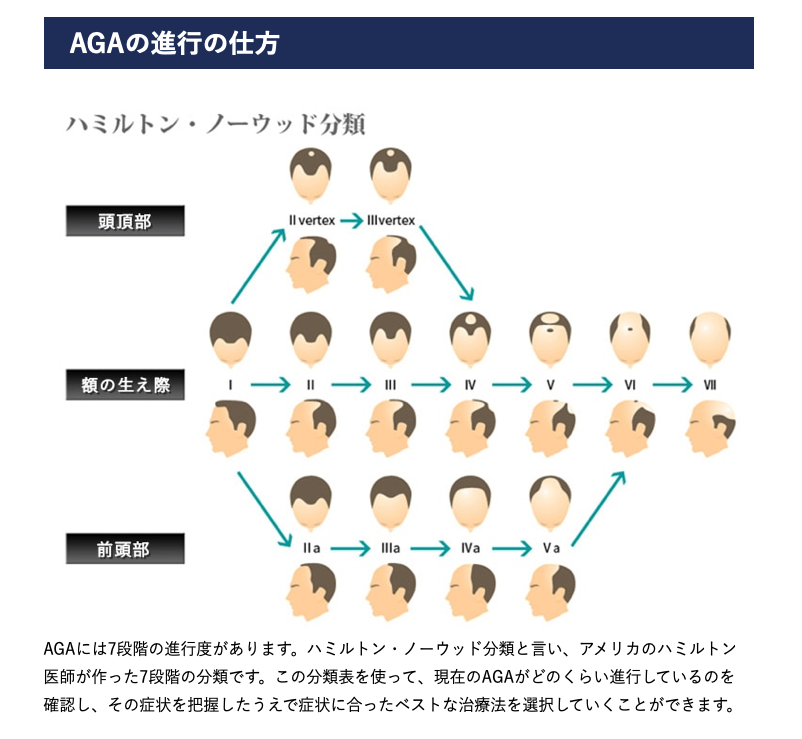 ウィルAGAクリニックについて公式 ウィルAGAクリニック